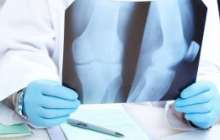 Сан зақымдалуы. | KazMedic