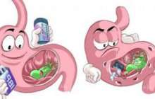 Созылмалы гастрит | KazMedic