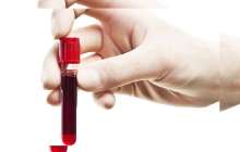 Түс жору: Түсінде қан көру. Қан түске кірсе ол нені білдіреді? • Түс Жору