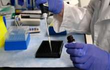 ​Склерозды емдеу әдісі табылды