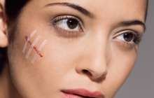 Тыртықтан қалай арылуға болады? | Reactor.inform.kz