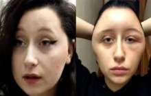 Шашын бояған бойжеткеннің беті ісіп кеткен