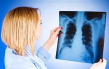 Мектеп асханасының қызметкерінен туберкулездің ашық түрі анықталды