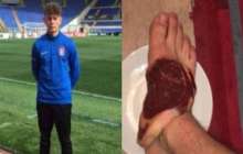 Футболшы командаласын шикі етпен емделуге мәжбүрлеген