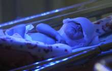 Ұлыбританияда терісіз сәби дүниеге келді