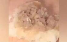 Жетісуда мектеп асханасындағы самсадан ақ құрттар шықты