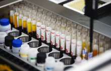 дәрігерлер ең қауіпті қан тобын атады