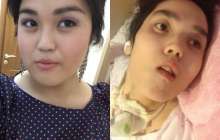 Төсекке таңылған қыздың анасы: Аяғымен барған баланы қолға көтеріп келдік