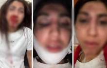 Балаларының көзінше жағы мен мұрнын сындырған: Бұрынғы күйеуінен таяқ жеген әйел Президенттен көмек сұрады