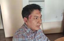 Тергеу органдарына сенбейтінін айтқан қырғыз журналисі өзіне жасалған шабуылды зерттейтінін айтты