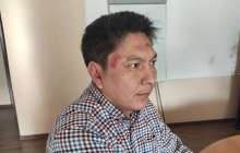 Бішкекте FactCheck.kg сайтының бас редакторын ұрып кетті