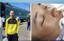 «Сөйлей алмайды»: Отарда комаға түскен сарбаз есін жиды