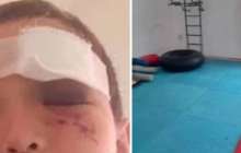 Оралда бес жасар бала MMA үйірмесіндегі қайғылы жағдайдан кейін бір көзінен айырылды