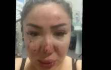 "Барлық дәлелді жариялап, өзімді өлтіремін": Желіде Әнару Құрманәлиева тосын мәлімдеме жасады