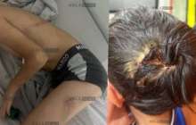 «Қазақмыс» қызметкері азаптаған 8 жасар баланың анасы көмек сұрады