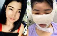 Мұрны мен құлағын кескен: күйеуінен зардап шеккен келіншекке ота жасалды