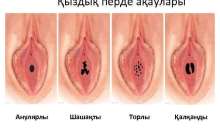 Әйел жыныс мүшелерінің ақаулары - презентация