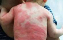 "Вакцина салған соң" түсірілген сурет қазақстандықтарды шошытты