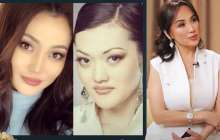 “Жақ сүйегін сындырған” - Ерке Есмахан пластикалық ота туралы айтты