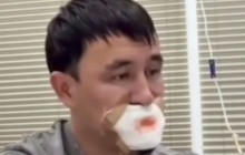 Сүйісіп, тілінен айырылған жігіт туралы тың ақпарат шықты