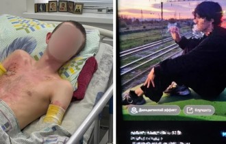 Қазақстандық дәрігерлер тоққа түскен жасөспірімді құтқарып қалды: Ол сурет үшін вагонның үстіне шыққан