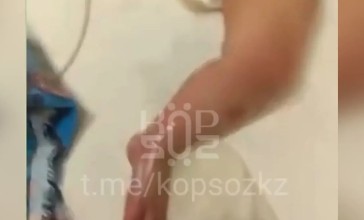 Астанада ауруханада 9 айлық сәби күйіп қалған