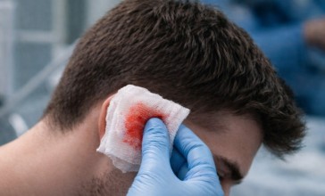 Атыраулық екі азамат жанжалдасып, бірі сол жақ құлағынан айырылды