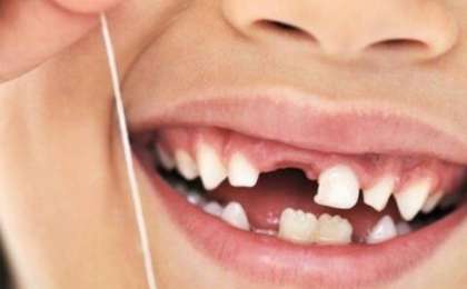 Сәбидің тісі тез шығу үшін