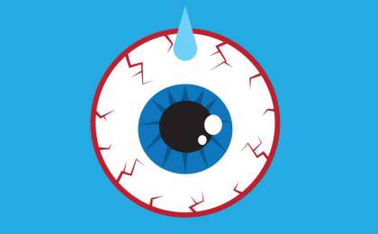 Құрғақ көз синдромы - Денсаулық - Bilim