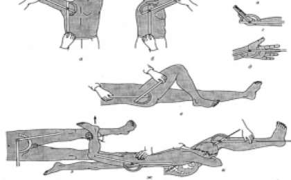 Буын қозғалғыштығын анықтау | KazMedic