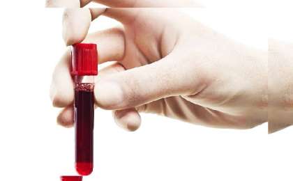 Түс жору: Түсінде қан көру. Қан түске кірсе ол нені білдіреді? • Түс Жору