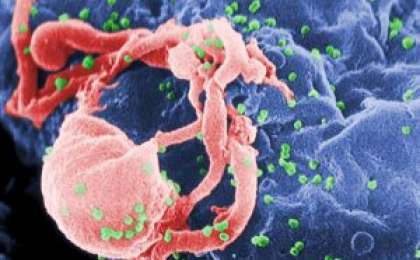 Лизосомалық аурулар