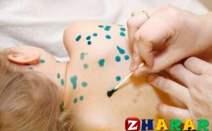 Шешекпен ауырған баланы емдеудің жолдары