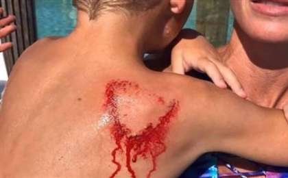 Әкесі ұлына жармасқан акуланы жұлып алды