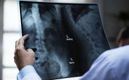 Алматылық хирург науқастың жамбасында бұрғының сынығын қалдырып қойған