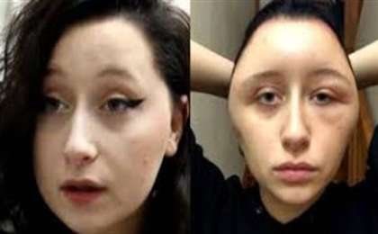 Шашын бояған бойжеткеннің беті ісіп кеткен