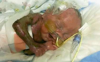 Терісі жоқ бала дүниеге келді