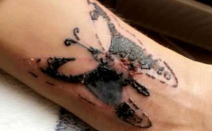 ​Тату салдырған бойжеткен аса қауіпті инфекция жұқтырған