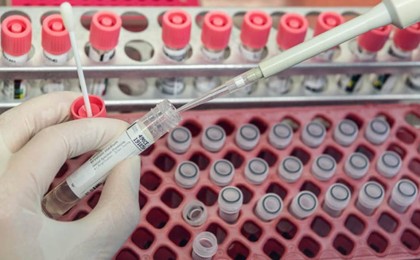 Қазақстанда тағы 314 адам коронавирус жұқтырды