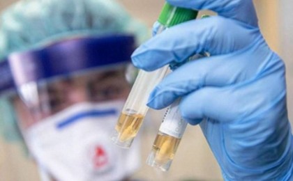 Бірінші тест теріс нәтиже көрсеткен: Павлодарда вирустан көз жұмғандардың саны неге көп - Қазақстан жаңалықтары