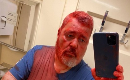 Нобель сыйлығының иегері Дмитрий Муратовқа шабуыл жасалды