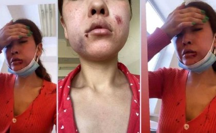 "Көлікке қамап қойып ұрып-соқты": Түркістандық бұрынғы әйелін аяусыз ұрған