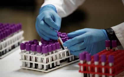 Елімізде індетке шалдыққандар саны 13 мыңнан асты