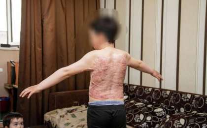 Үйде ешкім болмаған: елордалық баланың ауыр тағдыры елдің назарын аударды