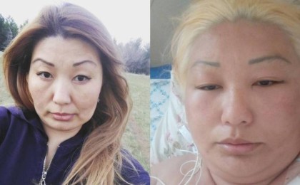 Оралда салонда шашын боятқан әйел аурухананың жансақтау бөлімінен бір-ақ шықты