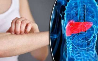 研究显示含铁量高的人更容易感染肝病