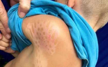 "Үтіктің іздері қалған": Талдықорғанда полиция арнайы балалар орталығындағы азаптау фактілерінен кейін тергеу бастады