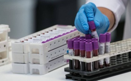 Қазақстанда коронавирус симптомдары жоқ науқастар саны артты