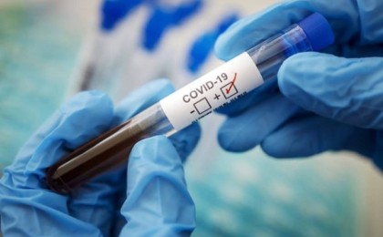 Министрлік Қазақстандағы Covid-19 және пневмония бойынша соңғы ақпаратты жариялады