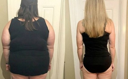 Әйел 76 келіден арылып, артық салмақ жоғалтудың тиімді әдісін ашты - Қазақстан жаңалықтары